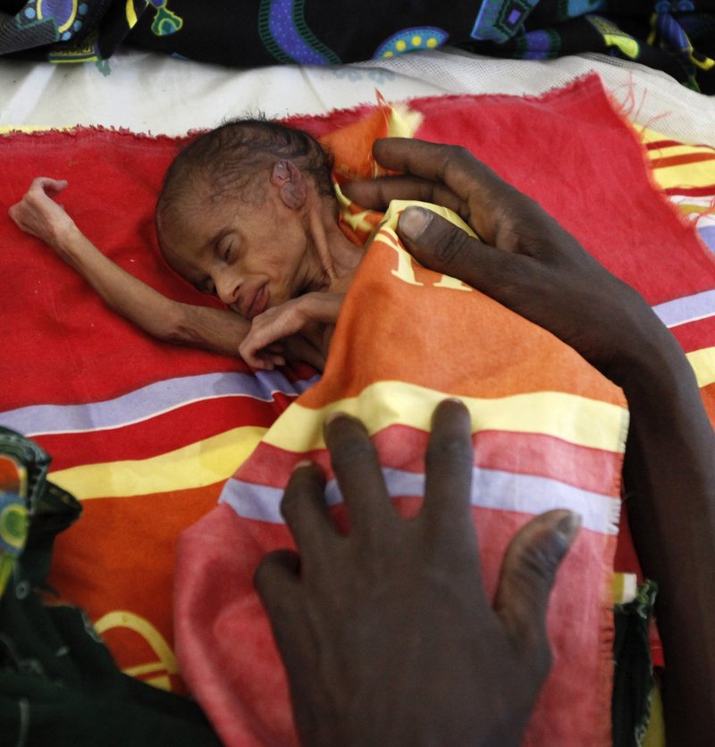 Odong Obong, barely 3 days old, is tended to by his mother as he lies with his triplet brothers, Opiew and Ochan, in a hospital ward in Akobo, southern Sudan, on Thursday. A recent survey found that almost 46 percent of children in the region are malnourished.