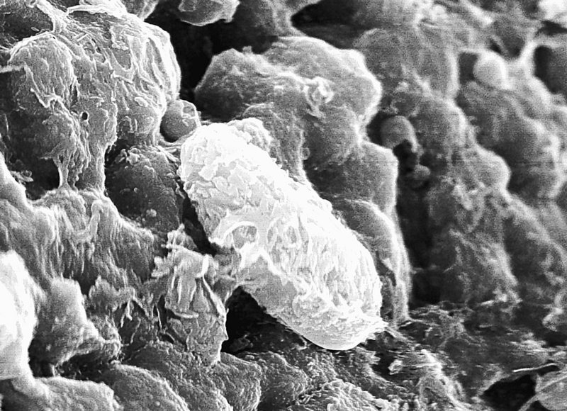 Microscopic fossils found on meteorites traced to Mars have been called proof that life has existed on that planet. Speaking at a NASA-sponsored conference in Texas, scientists presented data they say refutes some of the criticism they faced in 1996 when they proposed the idea of life on Martian meteors.