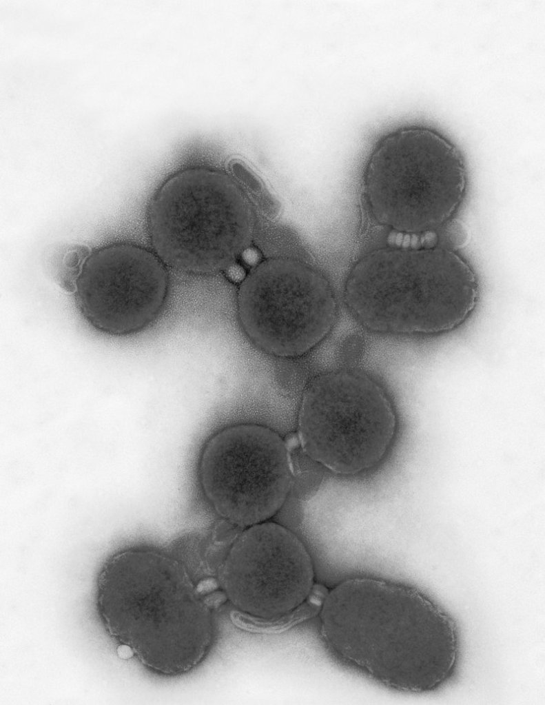 This image provided by the J. Craig Venter Institute shows electron micrographs of a simple germ named Mycoplasma. Researchers have implanted natural genomes and transformed germs before, but this week the Venter Institute announced they had implanted synthetic DNA that transformed the bacterium.