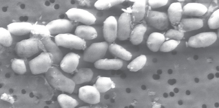 This undated black-and-white handout image provided by the journal Science shows a scanning electron micrograph of strain GFAJ-1. The discovery of a strange bacteria that can use arsenic as one of its nutrients widens the scope for finding new forms of life on Earth and possibly beyond. While researchers discovered the unusual bacteria here on Earth, they say it shows that life has possibilities beyond the major elements that have been considered essential.