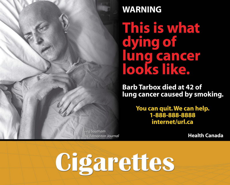 This is one of the explicit graphics that Canada uses for cigarette pack labels. Other countries have used such warnings for years, and various studies suggest they spur people to quit. Their effectiveness is up for debate, though, since the images are usually accompanied by other anti-smoking efforts.