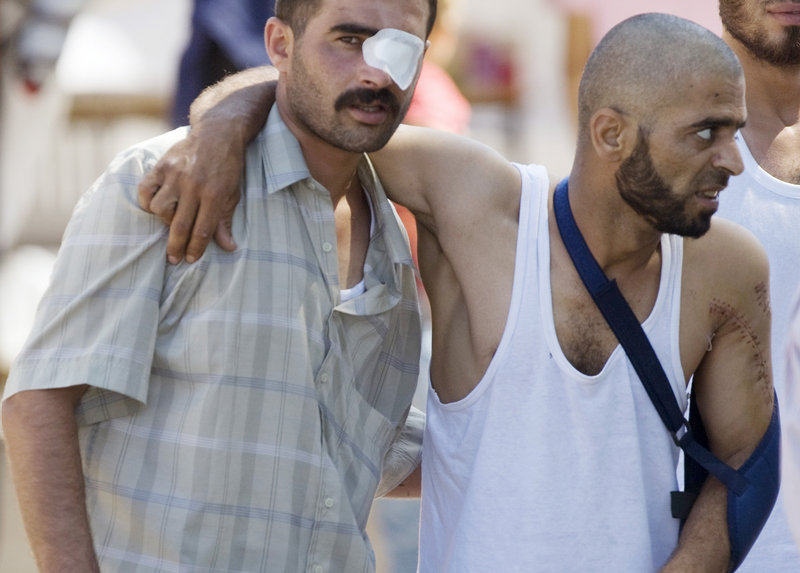 Wounded Syrian refugees walk toward an ambulance Wednesday in Yayladagi, Turkey. Turkey is sheltering more than 10,000 Syrians in four border camps, the U.N. said.