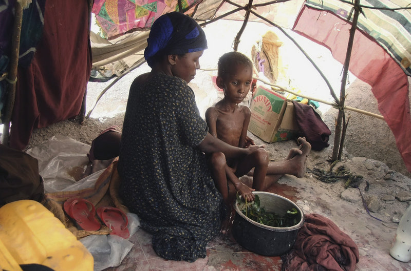A malnourished child from southern Somalia is washed in a herbal solution by her mother in a makeshift shelter in Mogadishu, Somalia. Al-Shabab, a militant group in Somalia, has previously banned the World Food Program from its region and 14 WFP workers have been killed since 2008.