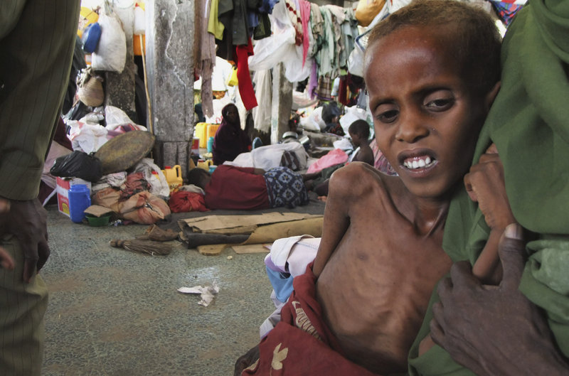 A malnourished child leans on his mother in a refugee camp in Mogadishu.