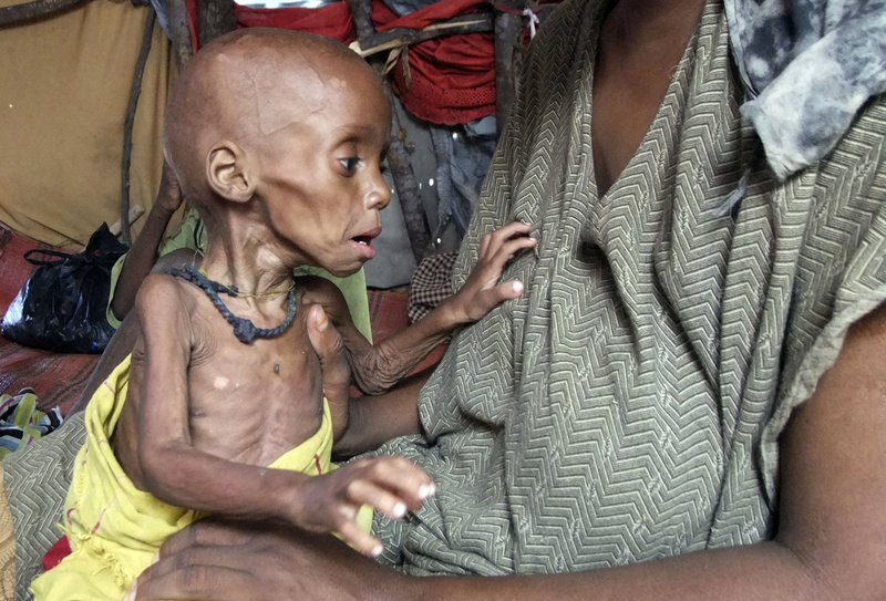 A severely malnourished child from southern Somalia is cared for Tuesday at a makeshift shelter inside a refugee camp in Mogadishu. A U.S. educator called Wednesday for the U.S. to expand its aid response “beyond incrementalism.”