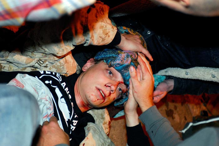 In this photo taken on Tuesday, 24-year-old Iraq War veteran Scott Olsen lays on the ground bleeding from a head wound after being struck by a projectile during an Occupy Wall Street protest in Oakland, Calif.