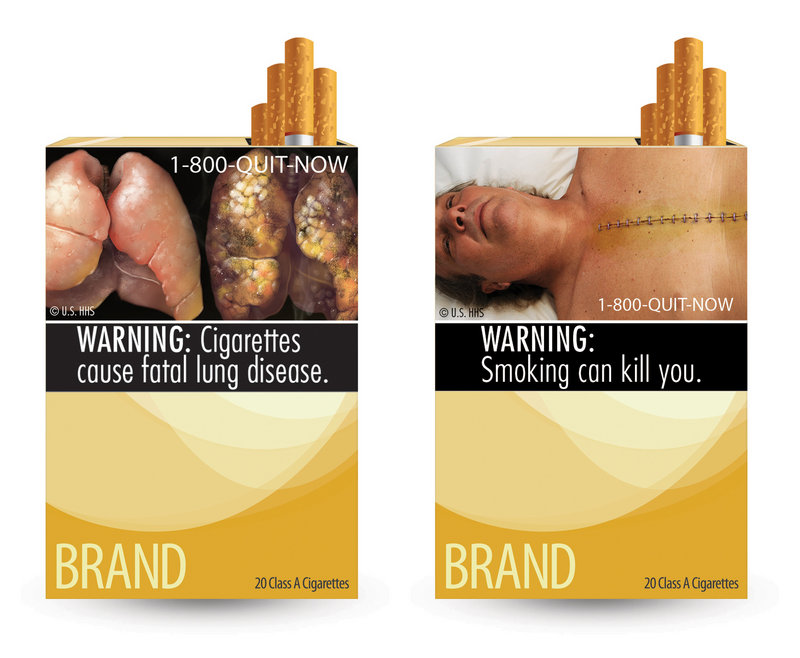 These are two of nine new warning labels approved for use on cigarette packaging. A judge says the images go beyond conveying the facts.