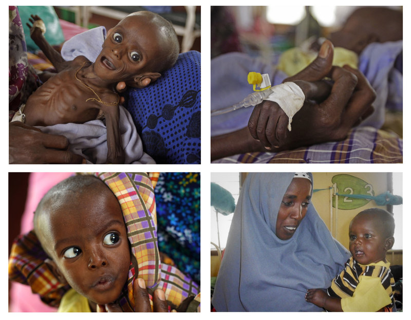 Minhaj Gedi Farah is shown at various dates of his recovery at the International Rescue Committee hospital in Dadaab, Kenya. At seven months, he weighed only 7.05 pounds. After weeks of feeding, he gained more than 10 pounds.