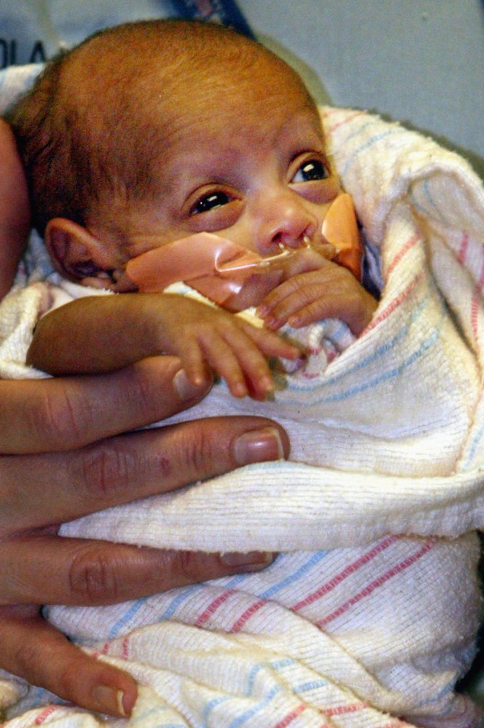 Rumaisa Rahman, seen Dec. 21, 2004, at Loyola University Medical Center, was born Sept. 19, 2004, weighing 9.2 ounces. Now a healthy first-grader, she is believed to be the smallest baby in the world ever to survive.