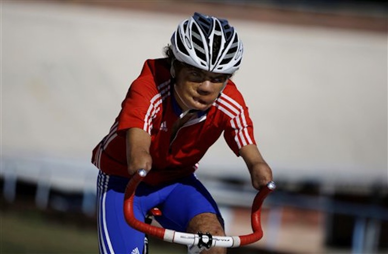 In this Jan. 26 photo, Damian Lopez, who was injured as a teenager by a high-voltage electrical wire when untangling a kite, trains at the Reinaldo Paseiro velodrome in Havana, Cuba. The accident cost him both his forearms, melted much of the skin from his face and left him in a coma from which doctors predicted he would never emerge. Twenty-two years later, Lopez, 35, is close to realizing an unlikely dream by representing Cuba at the 2012 London Paralympics in cycling, the sport that he says kept him from drowning in self-pity and despair. (AP Photo/Franklin Reyes)