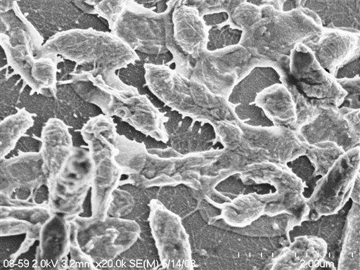 This image provided by UTMB-Galveston shows a scanning electron microscopic image of WT (wild type) Aeromonas hydrophila strain SSU, the bacteria responsible for the flesh-eating disease that is usually caused by a strep germ.