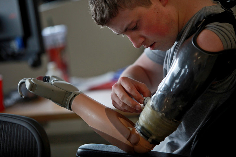 Army Pfc. Kevin Trimble, 19, adjusts his myoelectric upper limb prosthetic for occupational therapy at the Center for the Intrepid at Brooke Army Medical Center in San Antonio, Texas. At 19, Kevin has lost an arm and both legs above the knee from a bomb in Afghanistan.