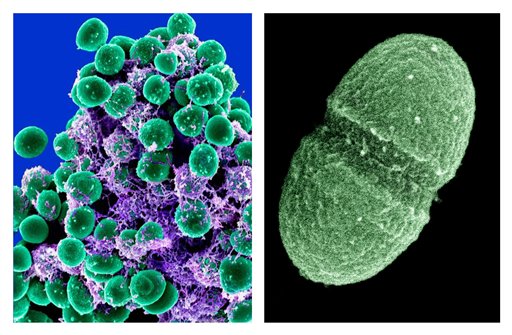 Image at left provided by the National Institute of Allergy and Infectious Diseases shows a clump of Staphylococcus epidermidis bacteria (green) in the extracellular matrix, which connects cells and tissue, taken with a scanning electron microscope. At right is an image provided by the Agriculture Department of the bacterium Enterococcus faecalis, which lives in the human gut.