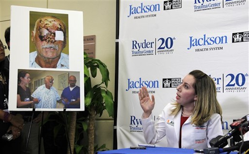 Dr. Wrood Kassira, right, a University of Miami/Jackson Memorial Hospital plastic surgeon, gestures as she speaks on the condition of Ronald Poppo, pictured at left, during a news conference, Tuesday, June 12, 2012 in Miami. Poppo was a homeless man whose face was mostly chewed off in a bizarre attack along a busy Miami street May 26. (AP Photo/Wilfredo Lee)