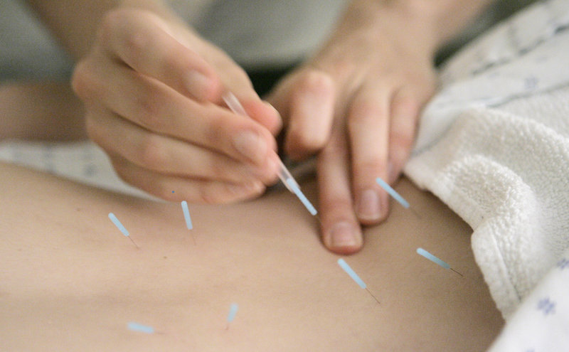 An acupuncture practitioner adjusts 1-inch seirin acupuncture needles in the muscles around the spine of a patient to relieve lower back pain at the Pacific College of Oriental Medicine in Chicago.