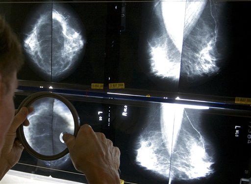 A radiologist uses a magnifying glass to check mammograms for breast cancer in Los Angeles in this 2010 photo.