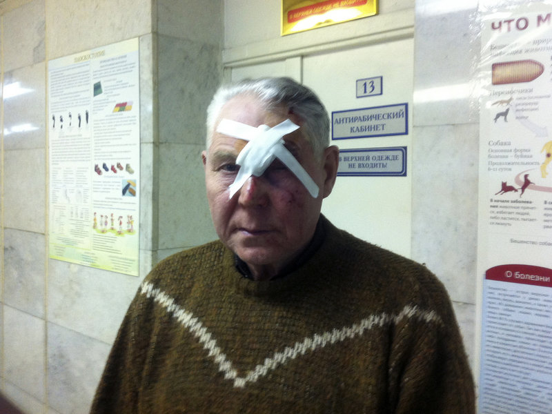 A man identifying himself only as Viktor has his face bandaged at a hospital in Chelyabinsk, Russia, where he sought treatment of injuries sustained after a meteorite exploded over the Ural Mountains on Friday, creating a shock wave that blew out windows and caused other damage. No one was killed.