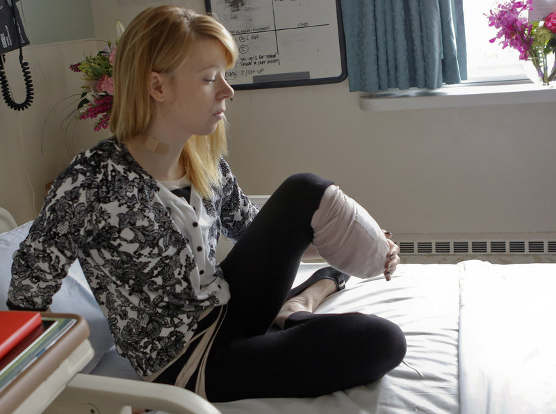 Adrianne Haslet, a professional ballroom dancer injured by a bomb that exploded near the Boston Marathon finish line, lifts her bandaged left leg in her bed Wednesday.