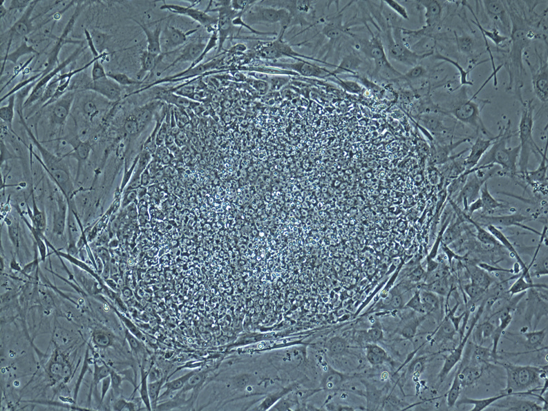 This undated image made available by the Oregon Health & Science University shows a stem cell colony developed from cloned human embryos.