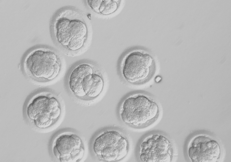 This undated image shows developing cloned human embryos.