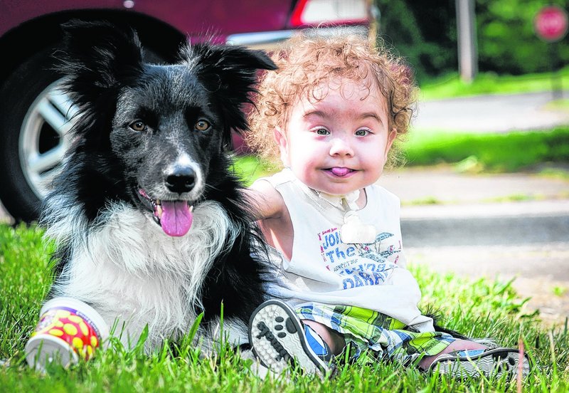 Kaiba Gionfriddo sits next to his family’s dog, Bandit, outside his Youngstown, Ohio home Tuesday. Gionfriddo had a groundbreaking airway surgery in 2012.