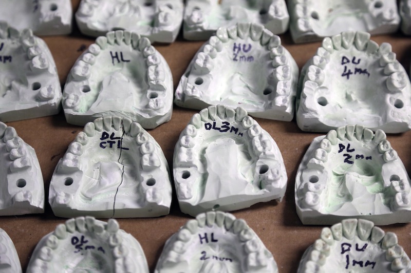 This April 17, 2013 photo shows dental molds that are part of an experiment showing systematic alteration of tooth position to determine when small differences in tooth arrangement can be recognized in bite marks in skin, at the school in Buffalo, N.Y. Bite marks, long accepted as criminal evidence, now face doubts about reliability. (AP Photo/David Duprey)