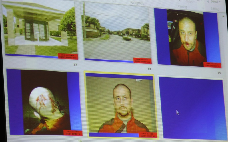 State evidence photos, including various photos of George Zimmerman on the night of the Trayvon Martin shooting, are projected on a video screen in the courtroom during Zimmerman's trial in Seminole circuit court, in Sanford, Fla., on Friday.