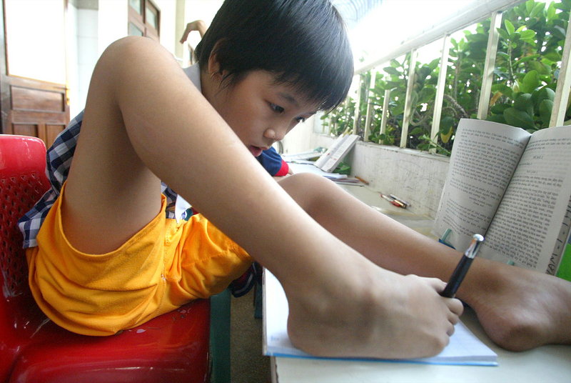 Born without arms, Pham Thi Thuy Linh, 10, writes with her foot at Tu Du hospital in Ho Chi Minh City in a 2004 photo. U.S. aid to help clean up the Agent Orange dioxin contamination and help existing victims has been minimal, but that may be changing.