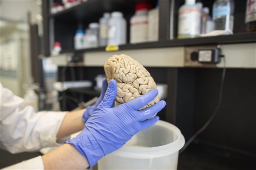 A researcher holds a human brain in a laboratory at Northwestern University's cognitive neurology and Alzheimer's disease center in Chicago. Studies show that in super agers, the brain's cortex, or outer layer, responsible for many mental functions including memory, is thicker than in typical 80- and 90-year-olds.