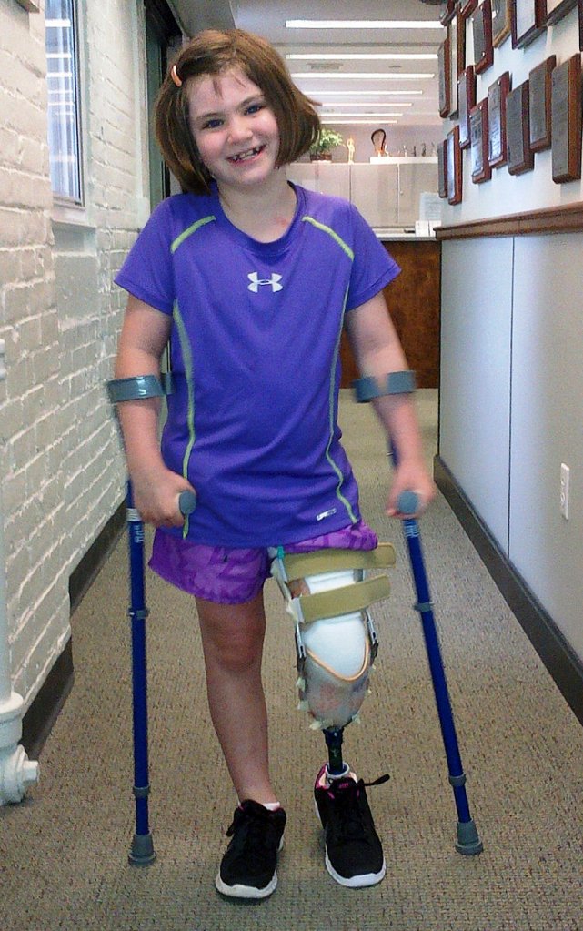 This photo released Thursday, Aug. 15, 2013, by the Richard family shows Jane Richard, 7, who lost part of her left leg in the Boston Marathon bombings on April 15, 2013, walking on a prosthetic leg in Boston. The family of Jane and her late brother Martin, 8, who was killed by one of the blasts, said in a statement that the little girl is already dancing on her prosthetic leg and “struts around on it with great pride.” (AP Photo/Richard Family)