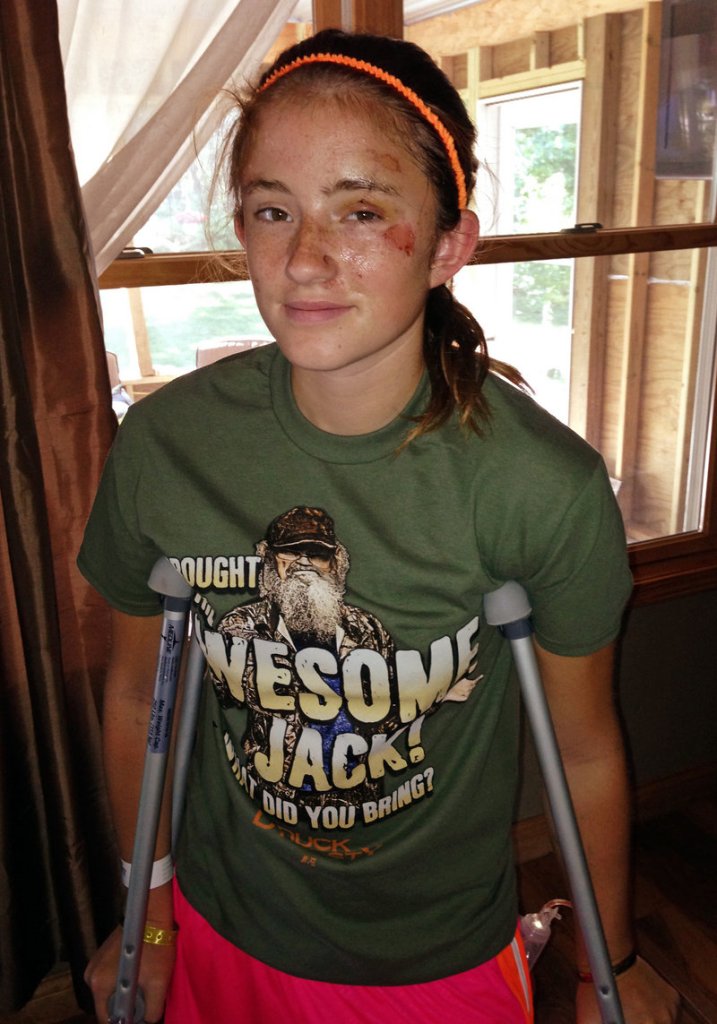 Abby Wetherell is shown at her home in Cadillac, Mich., after she was mauled by a black bear last Thursday.