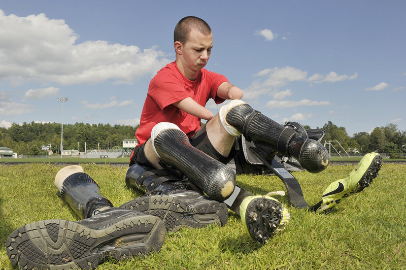 Josh Kennison of Norway, who was born without feet, arms, tongue and part of his jaw, attaches his prosthetic running legs before a run at Oxford Hills High School.