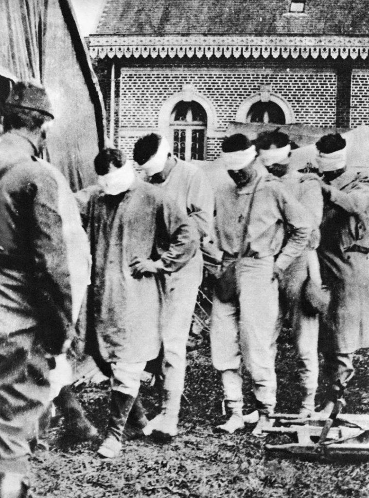 This World War I photo shows American prisoners of war captured by the Germans. Their eyes were bandaged after being wounded in a gas attack.