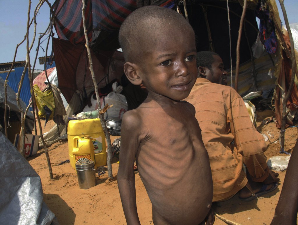A malnourished child stands in front of a makeshift shelter in Mogadishu, Somalia. Starvation is just one of the many challenges that will be “exacerbated” by global warming, a leaked report by an international panel says. Other challenges predicted to worsen because of world climate change include poverty, flooding, heat waves, droughts, war and disease.
