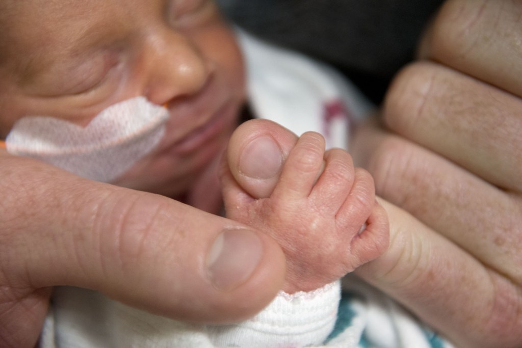 Brindabella holds the finger of her father, Tom Hepner at Sutter Memorial Hospital on Wednesday in Sacramento, Calif.