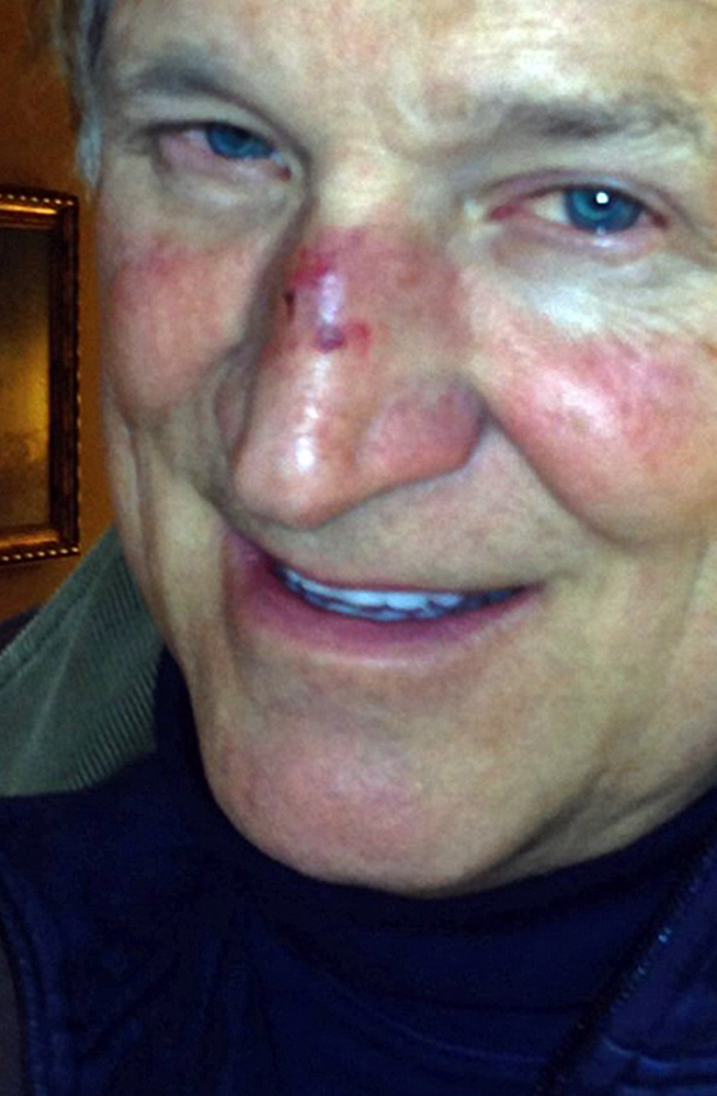 A cellphone photo shows John Yates in Ogunquit on Sunday after his fall due to passing out from carbon monoxide poisoning.