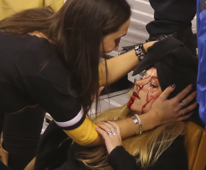 Caitlynn Brown helps her friend Sabina Grasso after a pole struck Grasso in the head following a Boston Bruins game Thursday night at TD Garden.