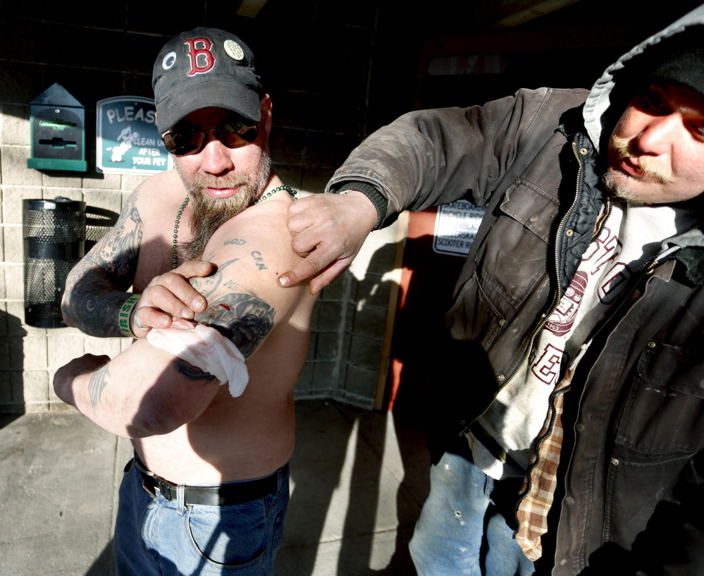 Two people were stabbed near the Casco Bay Lines ferry terminal in Portland on Friday. One of the stabbing victims, at left, shows a wound on his arm.
