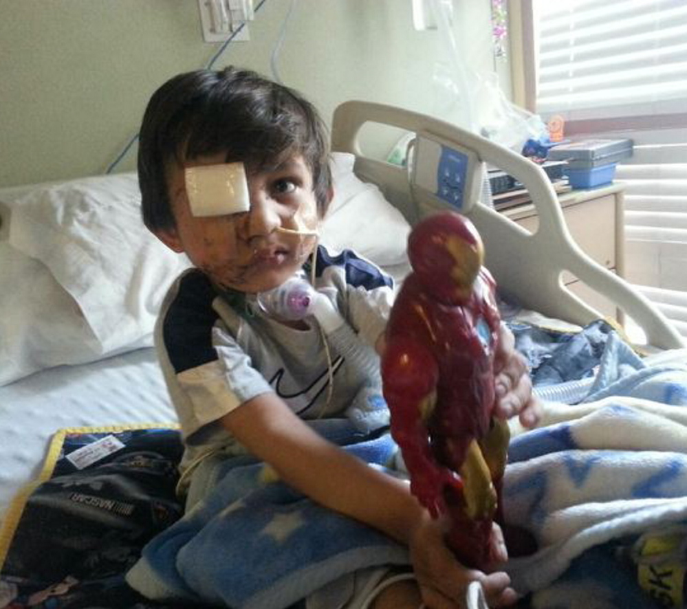 Four-year-old Kevin Vicente plays in his Phoenix, Ariz., hospital bed. He faces months, if not years, of reconstructive surgery after being mauled by a dog.