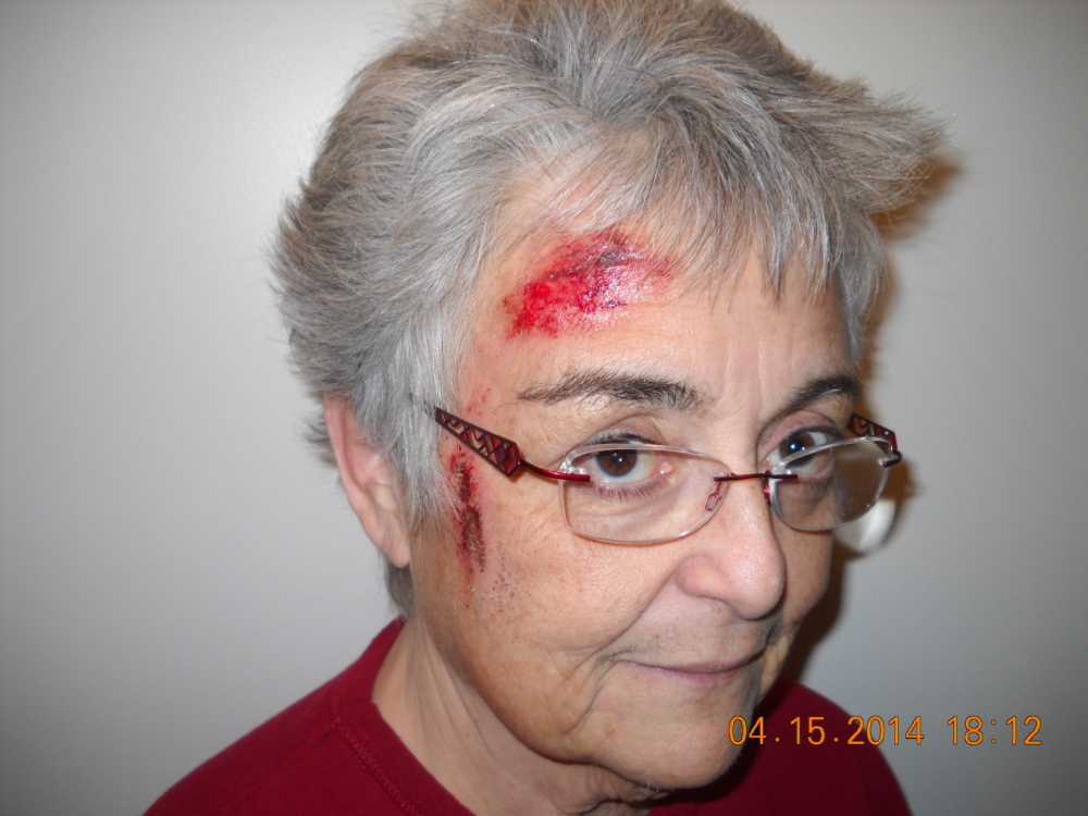 Deborah Nielson suffered injuries when she was attacked after walking in on burglars in her Buxton home.