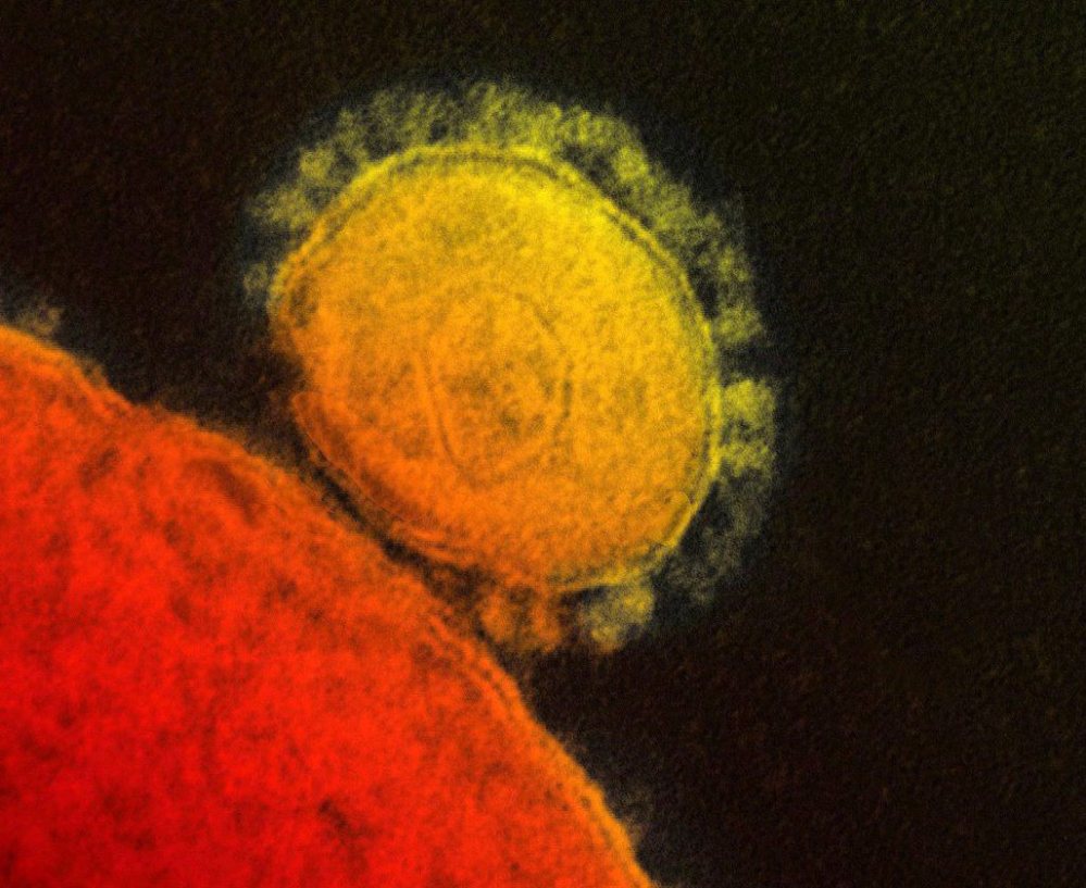 This photo shows a colorized transmission of the MERS virus that emerged in 2012.