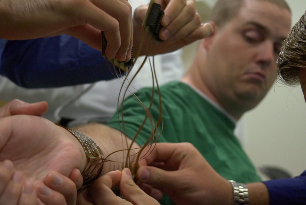 Electrodes are attached to Ian Burkhart’s arm during a training session June 18 at Ohio State’s Wexner Medical Center in Columbus, Ohio. The whole system is designed to bypass Burkhart’s broken spinal cord, translating thought to action.