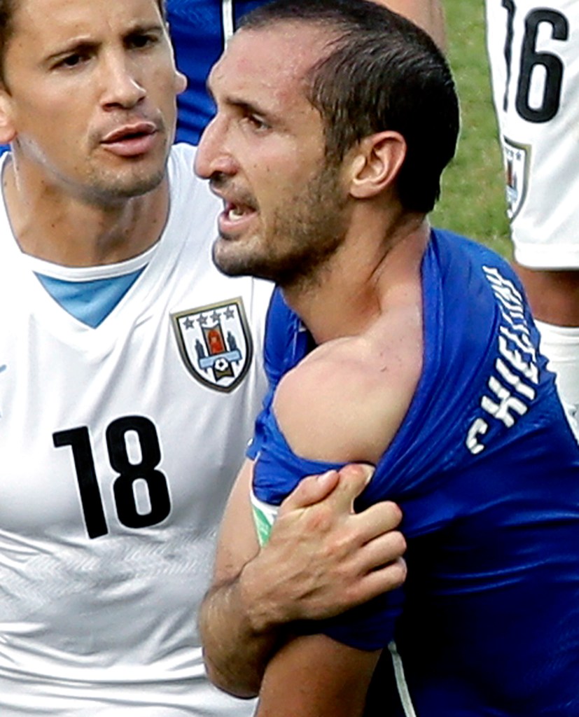 Italy's Giorgio Chiellini displays his shoulder showing apparent teeth marks after colliding with the mouth of Uruguay's Luis Suarez during the group D World Cup soccer match between Italy and Uruguay at the Arena das Dunas in Natal, Brazil, Tuesday, June 24, 2014.