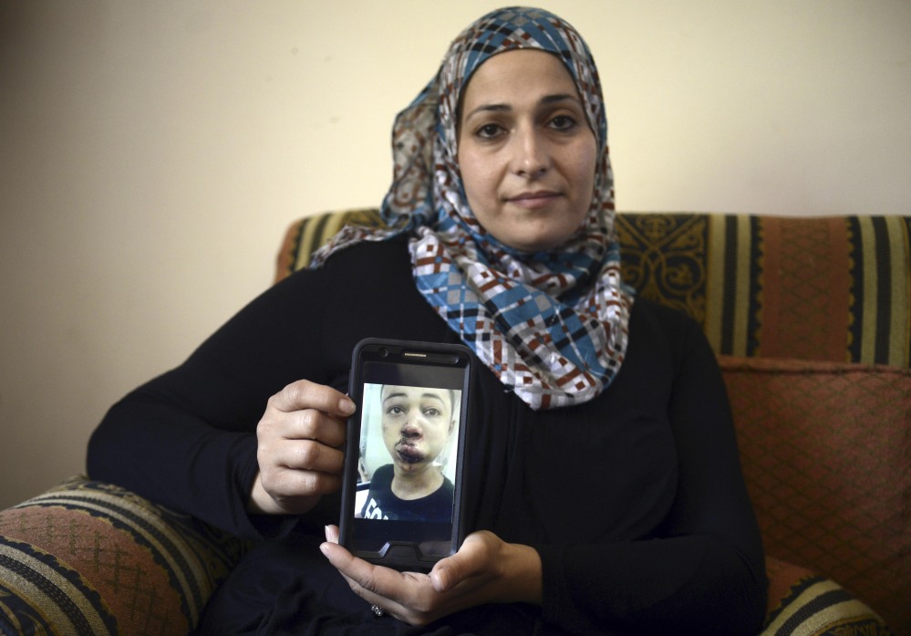 Suha Abu Khieder, mother of 15-year-old Tariq Abu Khieder, a U.S. citizen who goes to school in Tampa, Fla., shows a tablet with a photo of Tariq taken in a hospital after he was beaten and arrested by Israeli police during clashes sparked by the killing of his cousin Mohammad Abu Khieder in Jerusalem on Saturday. An Israeli police spokeswoman said Tariq had resisted arrest and attacked police officers. Tariq’s father said he witnessed his son’s arrest and insisted the boy was not involved in the violence.