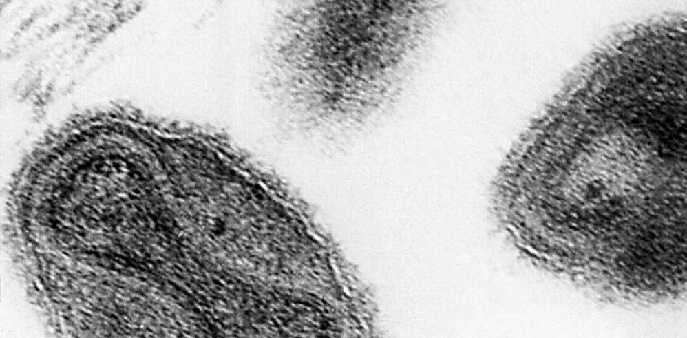 The smallpox virus in an electronmicrograph image from the Centers for Disease Control.
