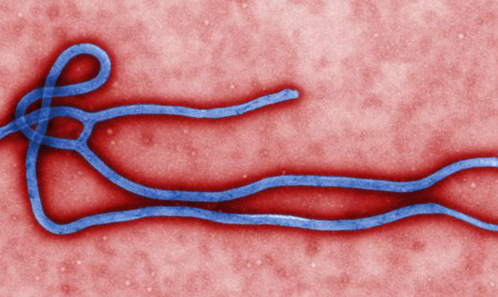 This photo provided by the CDC shows an Ebola virus germ. When the current outbreak in West Africa first began getting international attention, U.S. health officials said the risk of the deadly germ spreading to the United States was remote.