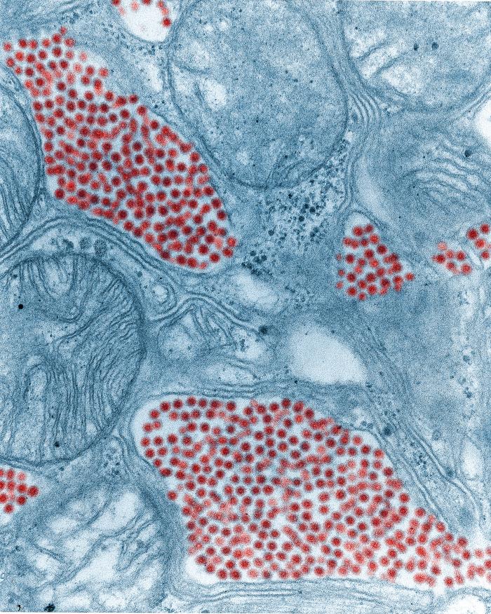 This colorized microscopic slide shows the Eastern Equine Encephalitis virus in red. The EEE virus is carried by mosquitoes that pick it up from infected wild birds. Wikipedia image