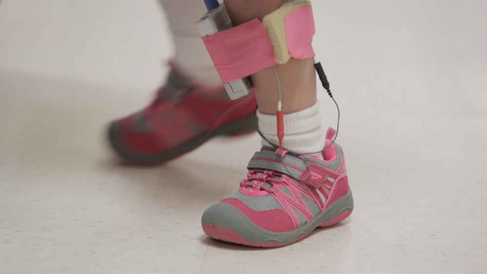 Zoey Houston wears sensors that stimulate nerves in her leg as she learns to walk again at New England Rehabilitation Hospital of Portland.