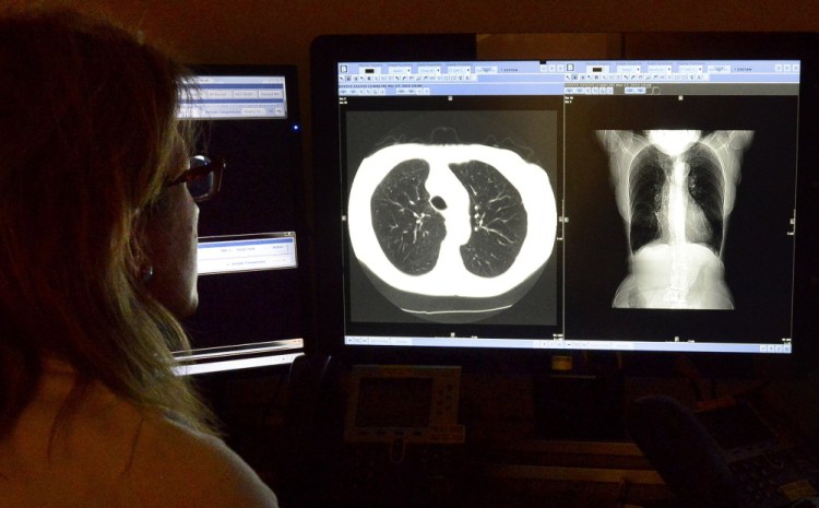 Dr. Elena Wechsler, a radiologist at Mercy Hospital in Portland, studies the results of a CT scan on a smoker’s lungs. The hospital charges $250 out-of-pocket for the procedure, now covered by Medicare.
