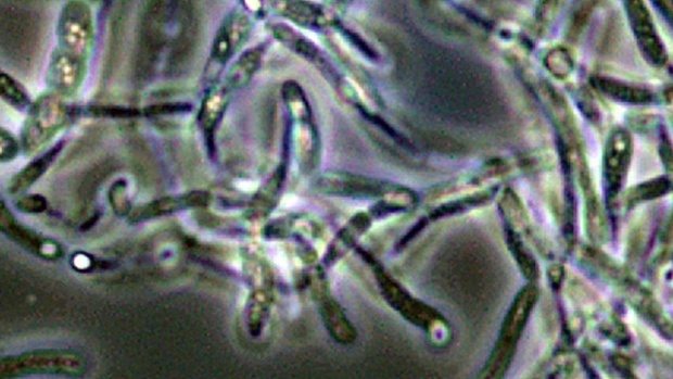 Live anthrax spores are viewed through a microscope in this CDC photo.